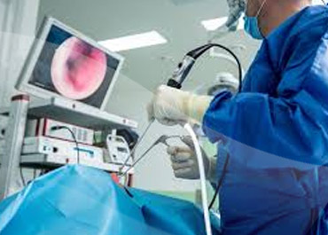 Esophageal Variceal Banding